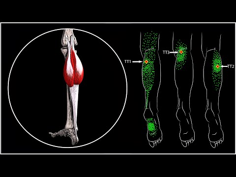 Video: Кантип ойноо керек 4 өлүк