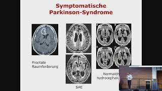 Vortrag „Bildgebende Verfahren bei Parkinson“