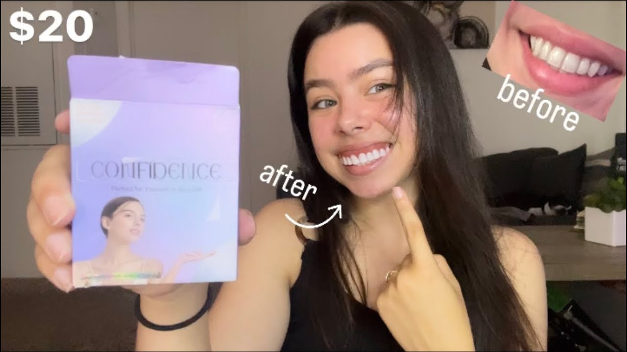 I TRIED INSTANT VENEERS FROM AMAZON