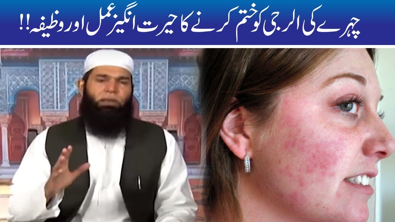 Chehre Ki Allergy Se Nijat Ka Wahid Wazifa | Hakeem Tariq Mehmood | Ubqari