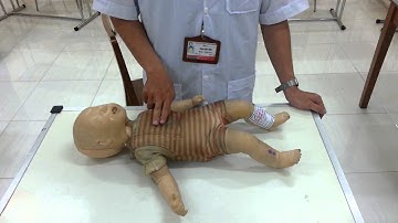 Cấp cứu ngưng tim ngưng thở ở trẻ em