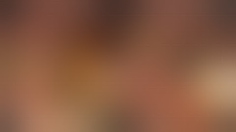 ERCP Stone Extraction #BD_ENDOSCOPY