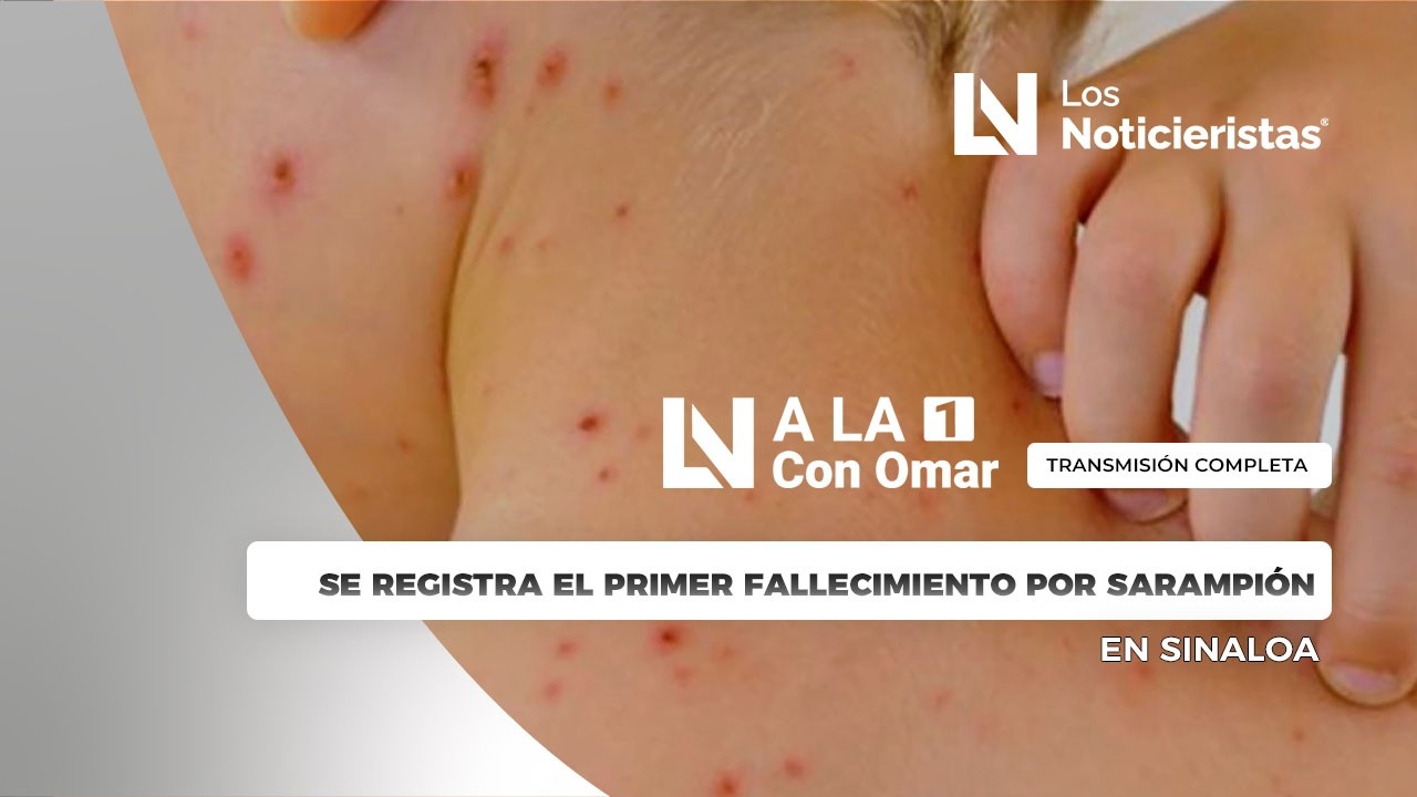 Se registra el primer fallecimiento por sarampión en Sinaloa