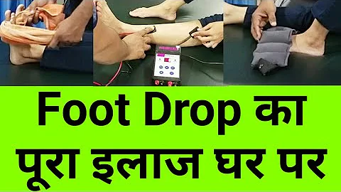 complete foot drop treatment at home - exercises , massage , electric stimulation - Physiotherapy