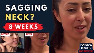 SAGGING NECK? HOW I LIFTED & TIGHTENED MY NECK IN 8 WEEKS (NO BOTOX)