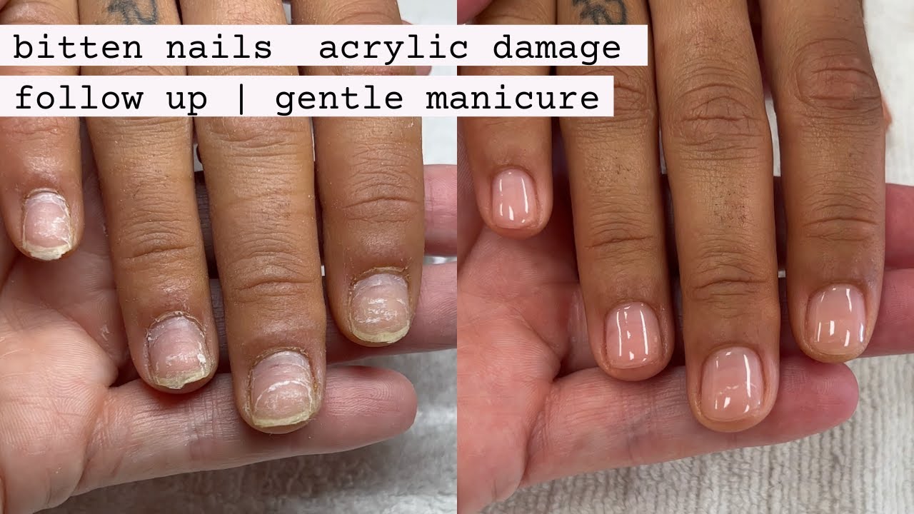 Gentle Shellac Removal and Manicure [How nail shape can change after polish  wear] 