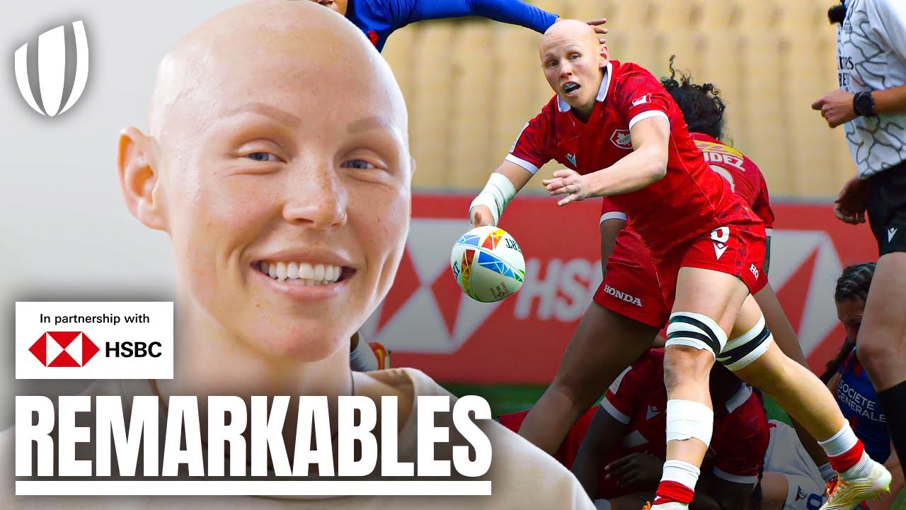 'This is who I am. This is the way I look.' Olivia Apps on Alopecia and ...
