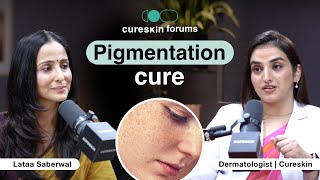Pigmentation questions answered by Cureskin doctor | Cureskin forums with @lataasaberwal