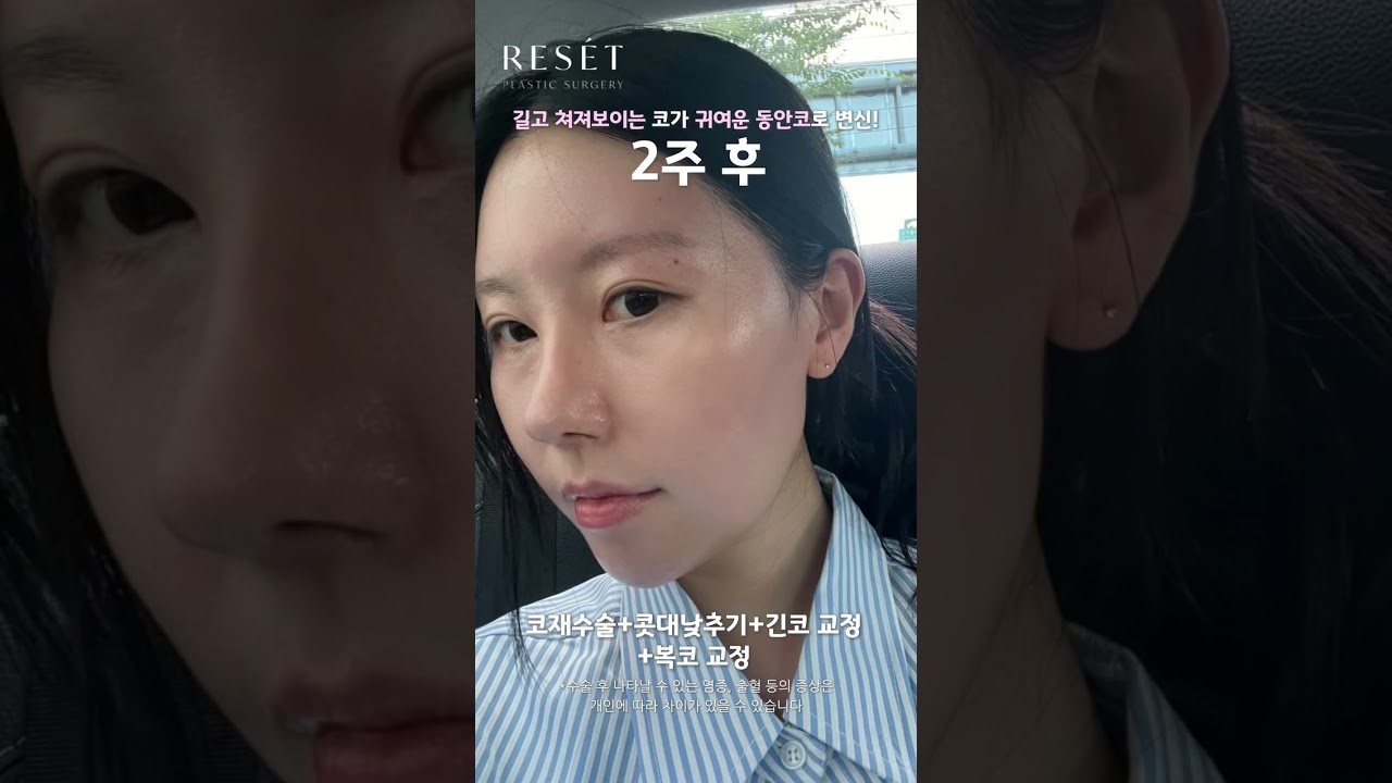 등록한썸네일