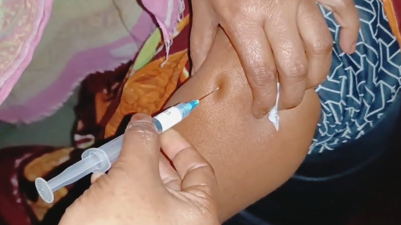 How to Give Arm IM Injection (Soma-Ject) | Family Planning Method | 25 ...