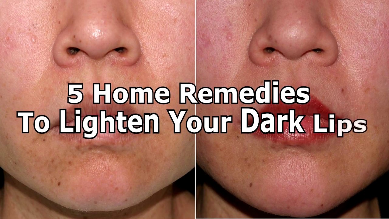 5 Home Remedies To Lighten Your Dark Lips YouTube