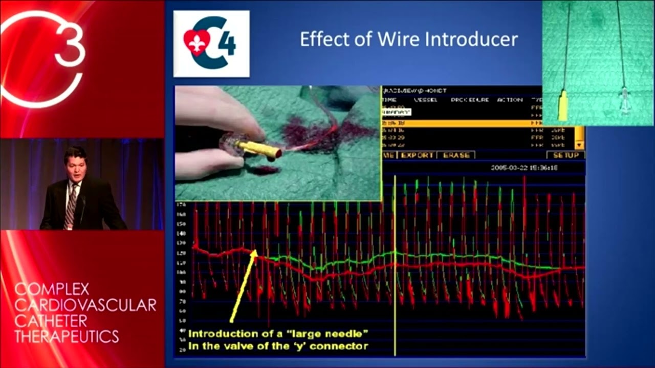 Fractional Flow Reserve (FFR)  problems: Tips and Tricks