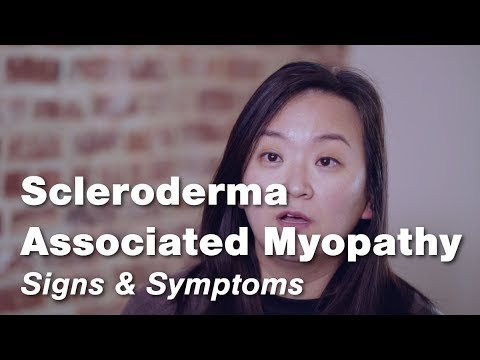 Scleroderma Associated Myopathy- Signs & Symptoms | Johns Hopkins