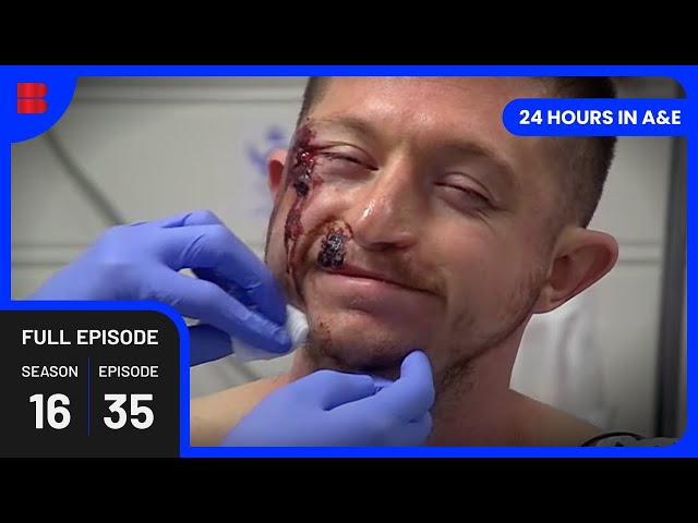 Bleeding Tonsils Nightmare  - 24 Hours in A&E - Medical Documentary class=