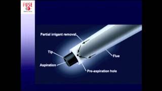 Fundamentals for the Use of Surgical Energy (FUSE): Ultrasonic Energy Systems - Part 2