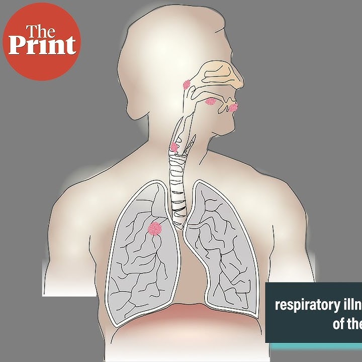 What is Nipah virus — the infection re-detected in Kerala