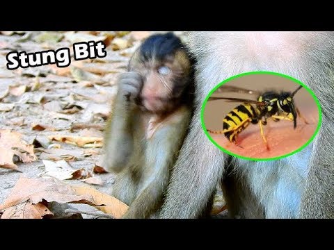 Pity Small Boy Tobias Has Itchy After Stung Bit | Tobias Try Take His Hand So Fast To Reduce Pain