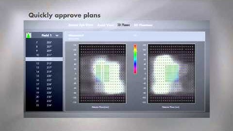 Sistema Delta4 para control de calidad en radioterapia