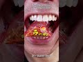 Satisfying Chewing ASMR #Compilation #ASMR #DoctorTristanPeh