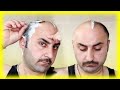 Bald is Beautiful: My Razor Head Shave Experience