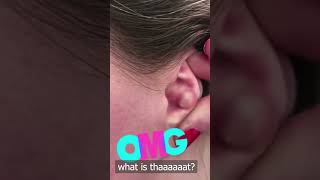 pimple popping 2022 new, blackheads on nose, pimple popping tiktok #23523235