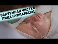 Чистое лицо за полчаса! Вакуумная чистка лица HydraFacial