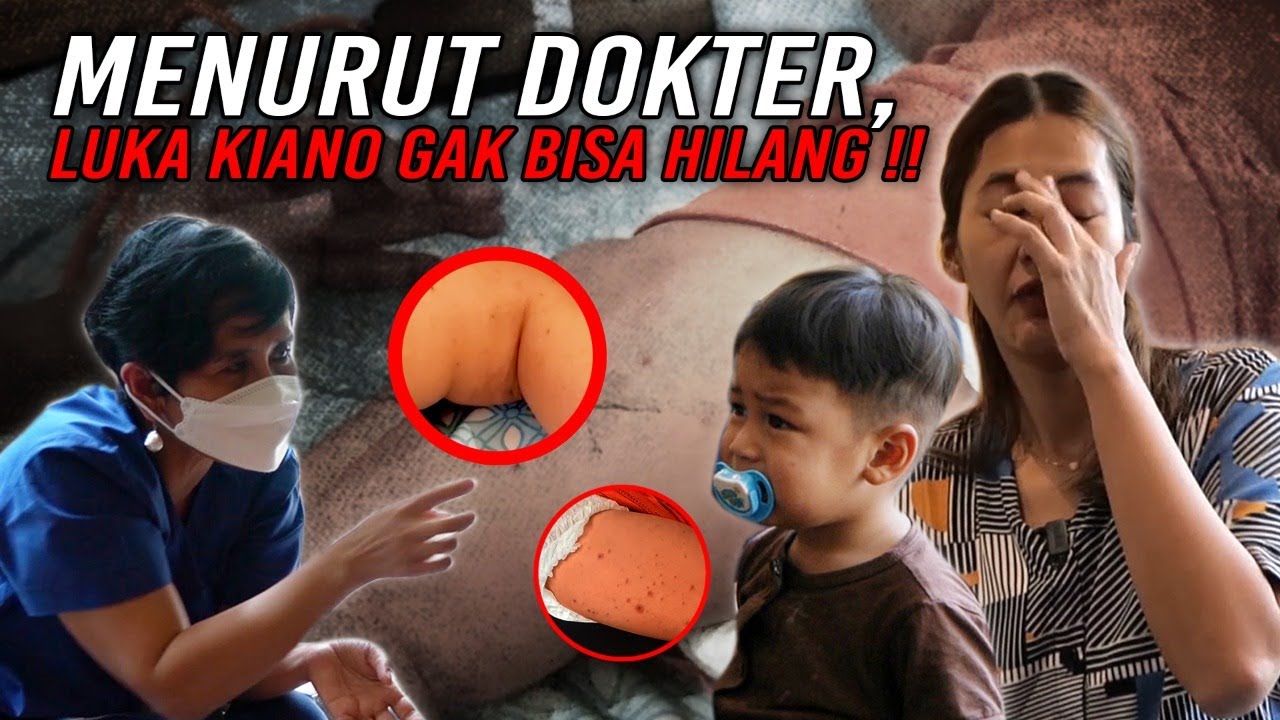 FLU SINGAPORE INI BERBAHAYA ..DAN GA ADA OBATNYA..