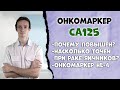 Онкомаркер CA125: рак яичника или нет?