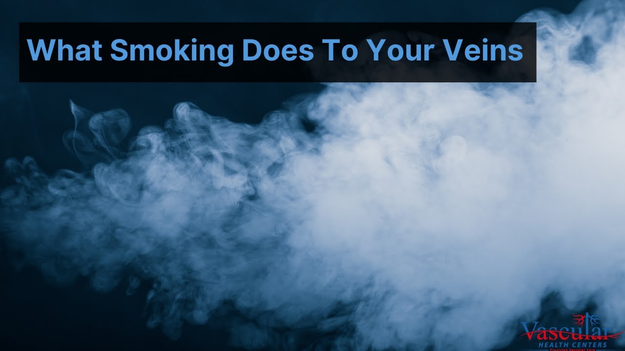 What Smoking Does To Your Veins | How To Prevent Vein Disease - YouTube