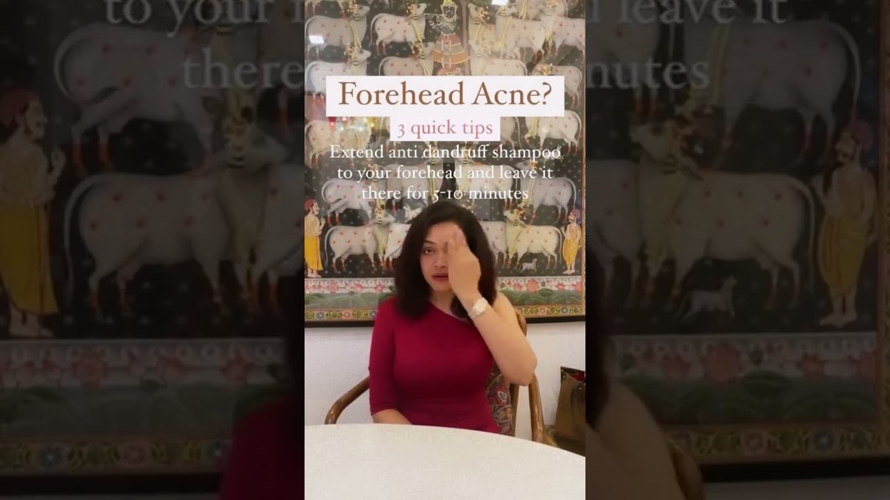 3 Simple Quick Tips If You Have FOREHEAD ACNE 