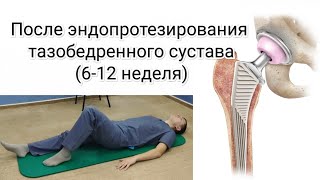 Лечебная гимнастика после эндопротезирования тазобедренного сустава (6-12 неделя)