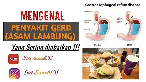 Yuk Kenali Penyakit Asam Lambung... - Health Education