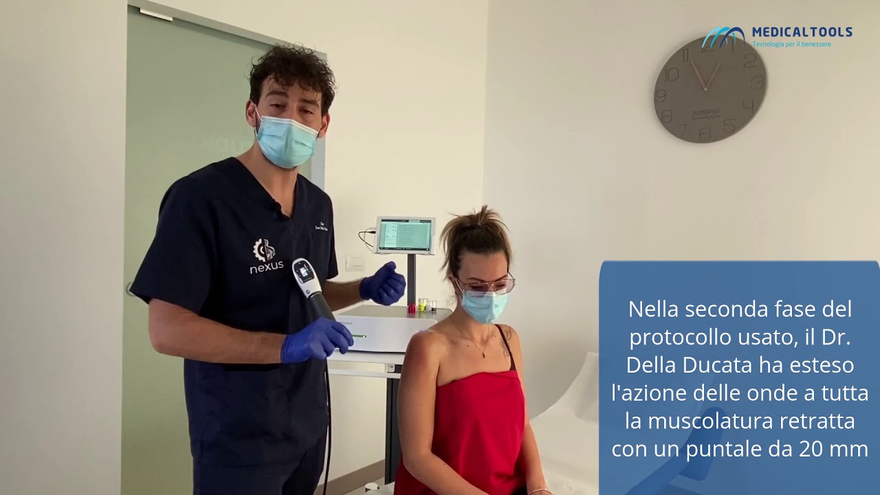 uso delle ONDA D'URTO radiali MP100 STORZ nelle tendiniti del fisioterapista Dr L. Della Ducata