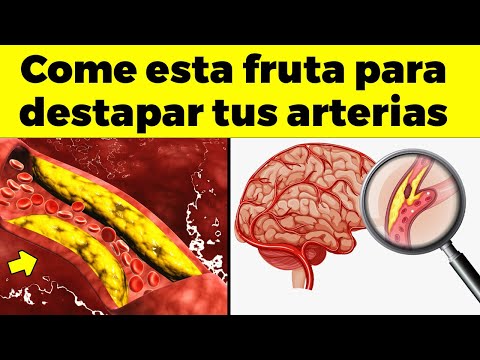 Esta es la MEJOR FRUTA para limpiar tus vasos sanguíneos