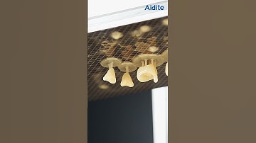 🦷 EZPRINT CROWN SYSTEM!