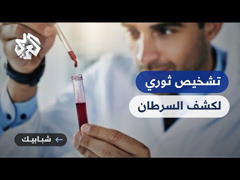 أبحاث فرنسية قد تشكل ثورة في مجال مواجهة السرطان ما علاقة فحوص الدم بالتشخيص المبكر