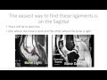 Read Knee MRI ACL and PCL - Help with Reading MRI