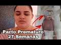 RELATO DE PARTO 27 SEMANAS (PREMATURO EXTREMO)