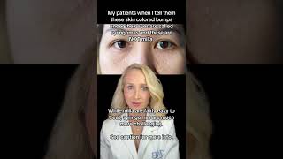 Derm Reacts to Skin Bumps | Milia or Syringoma | #shorts