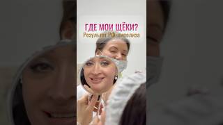 Убрать брыли за 10 минут