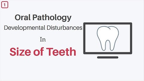 Developmental Disturbances in Size of Teeth: Oral Pathology