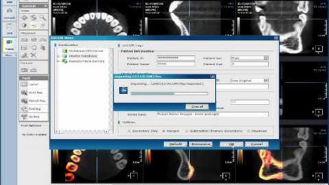 Fusion_Stitching.wmv