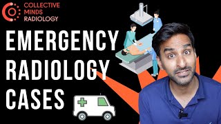 Celebrity Emergency CT Abdomen Cases - made easy!? Profile