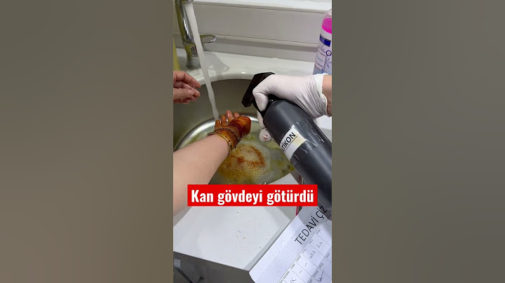 Bu sefer ısırıldık 😅