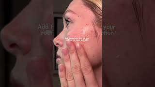 Winter Skin Woes? 6 Must-Know Tips For Dry Skin