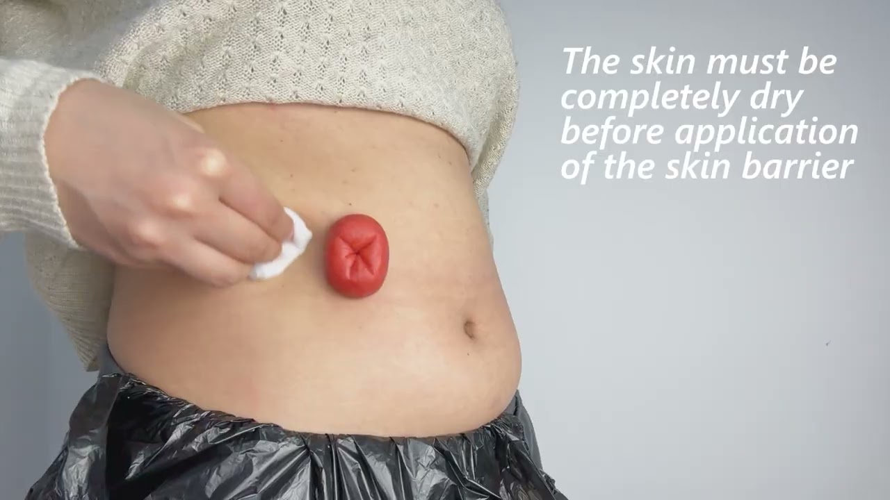 Calmlora Series 1-Piece Closed Pouch - How To Use#zodelo #Calmlora Series #ostomybag #ostomycare