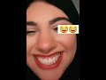 اقوى ضحكة حتموت ضحك وحتعيدها كلما تشوفها بتضحك اقوى ضحكة حتموت ضحك وحتعيدها كلما تشوفها بتضحك
