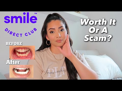IS SMILE DIRECT CLUB A SCAM? | MY EXPERIENCE WITH SMILE DIRECT CLUB | Amber Vazquez