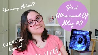 Dating Scan Not What I Expected || Baby Measuring 1 Week Behind