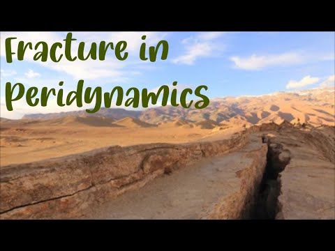 Fracture in Peridynamics